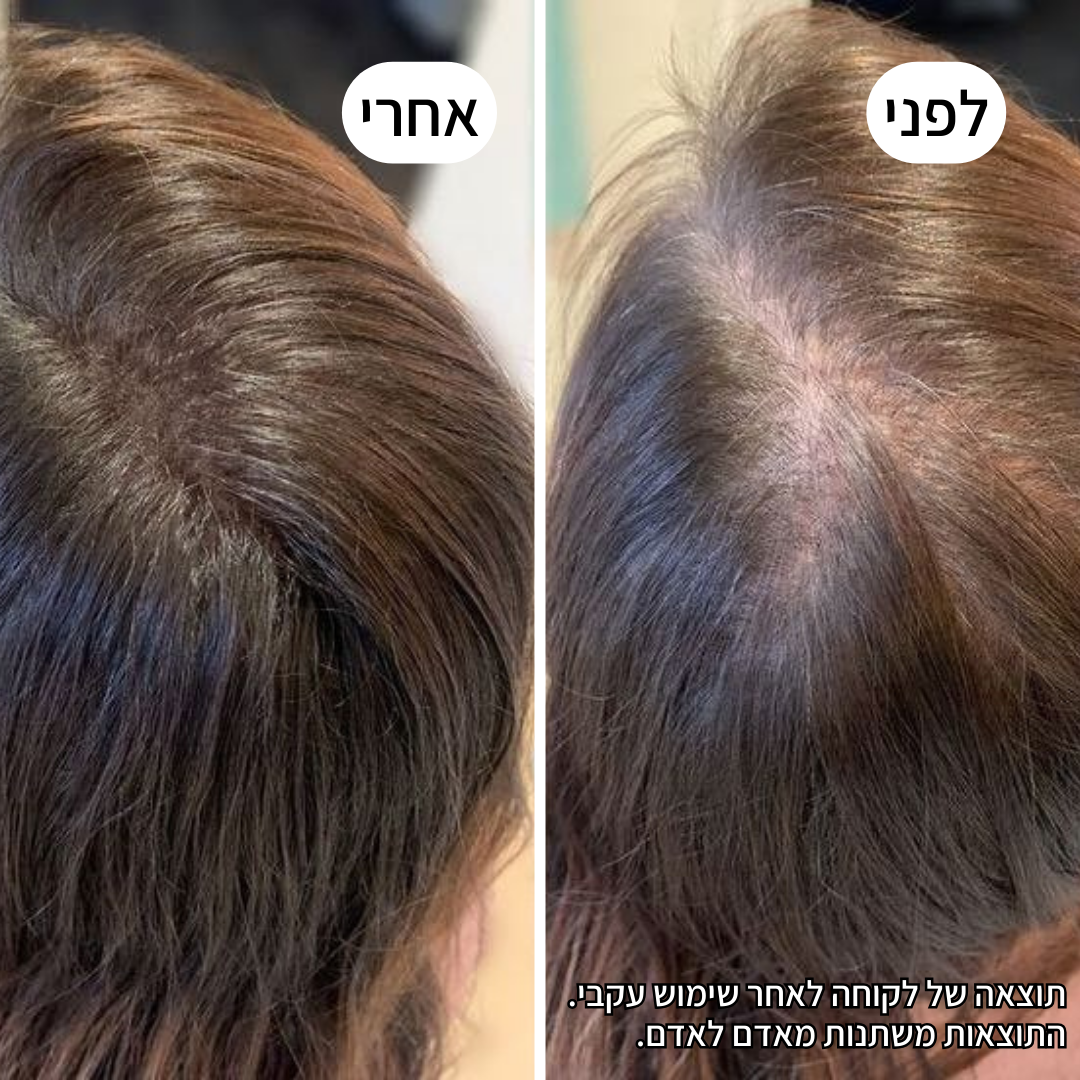 Rootex TYLI - קבלי מראה שיער חזק ובריא יותר כבר בחודש הראשון