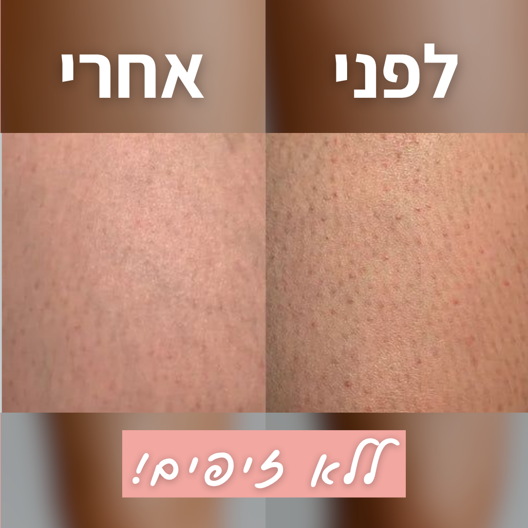 מכונת הגילוח של TYLI
