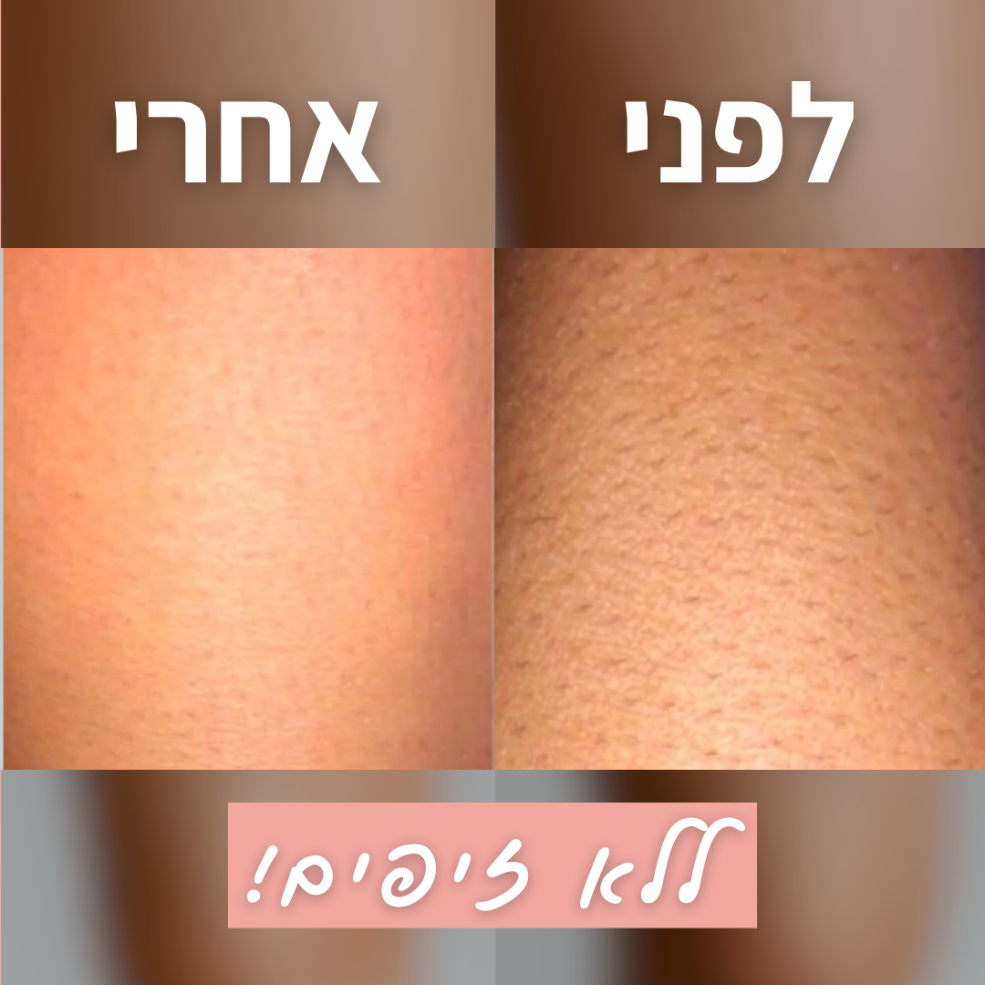 מכונת הגילוח של TYLI