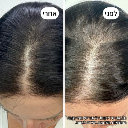 Rootex TYLI - קבלי מראה שיער חזק ובריא יותר כבר בחודש הראשון
