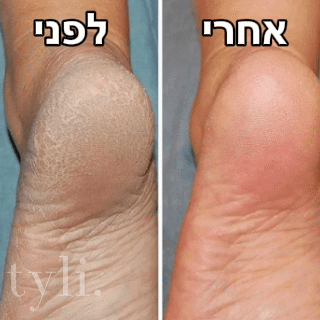מסיר עור מת בכף הרגל TYLI - עור חלק בחמש דקות!