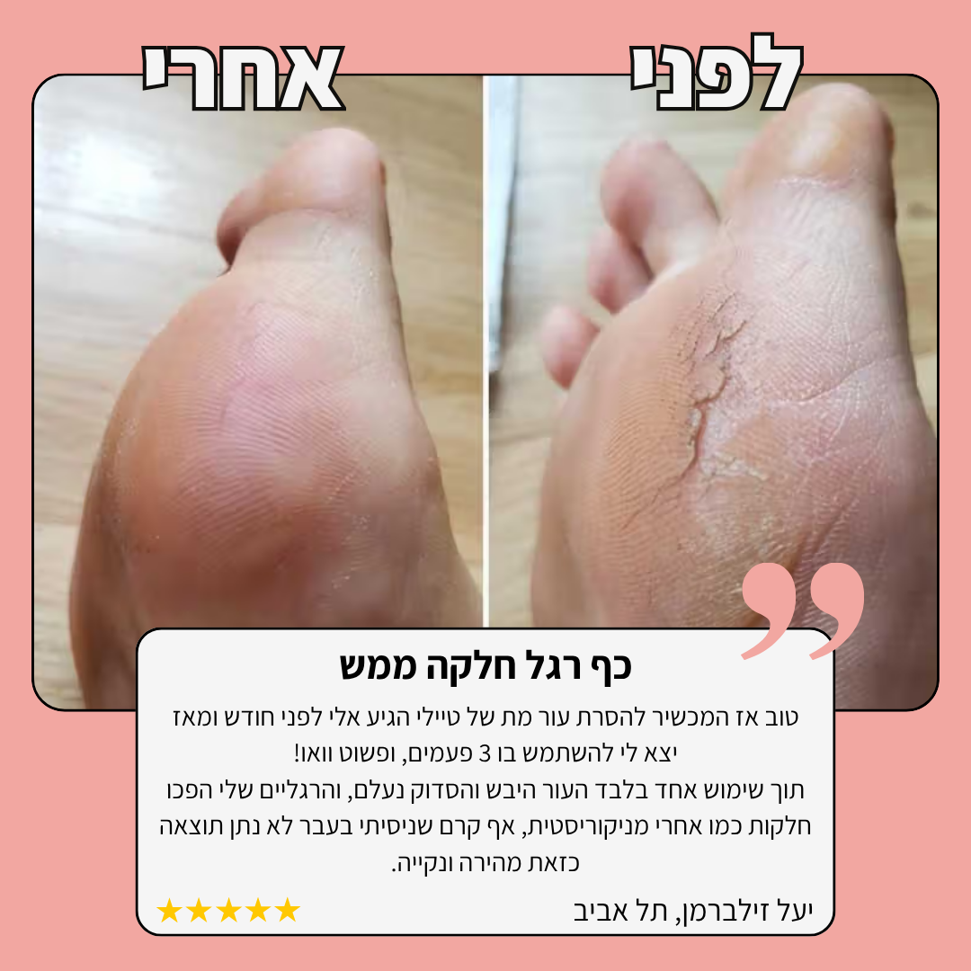 מסיר עור מת בכף הרגל TYLI - עור חלק בחמש דקות!