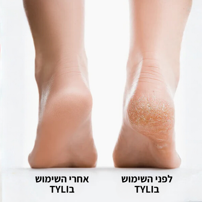 מסיר עור מת בכף הרגל TYLI - עור חלק בחמש דקות!
