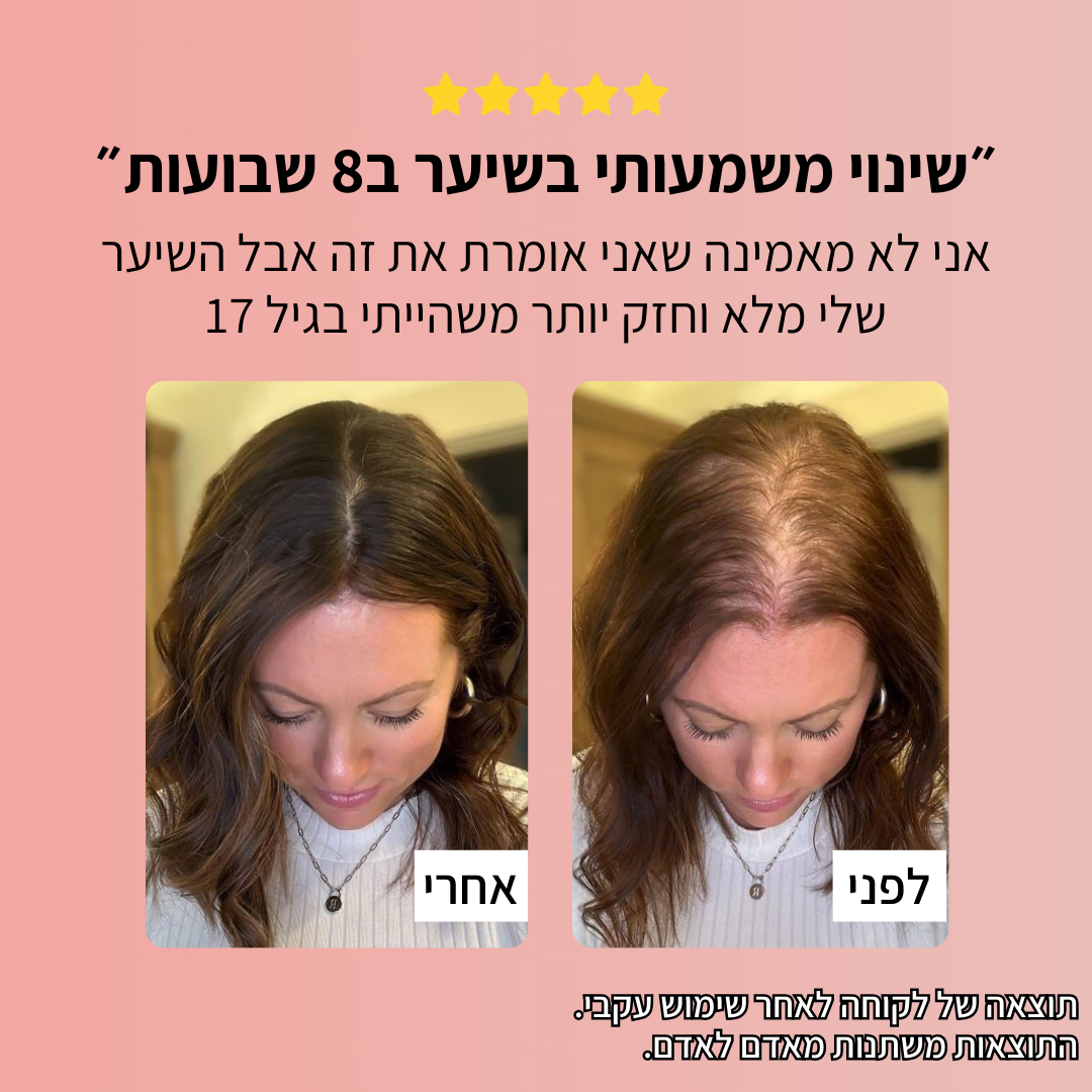 Rootex TYLI - קבלי מראה שיער חזק ובריא יותר כבר בחודש הראשון