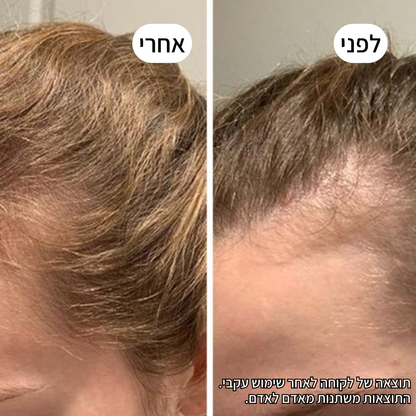 Rootex TYLI - קבלי מראה שיער חזק ובריא יותר כבר בחודש הראשון