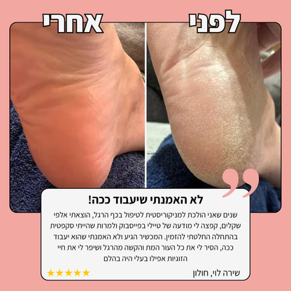 מסיר עור מת בכף הרגל TYLI - עור חלק בחמש דקות!