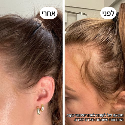 Rootex TYLI - קבלי מראה שיער חזק ובריא יותר כבר בחודש הראשון