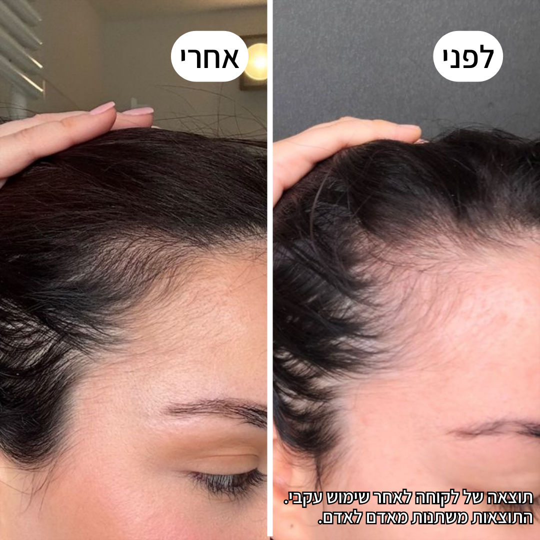 Rootex TYLI - קבלי מראה שיער חזק ובריא יותר כבר בחודש הראשון