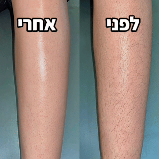 מכונת הגילוח של TYLI - עור חלק במהירות ללא חתכים